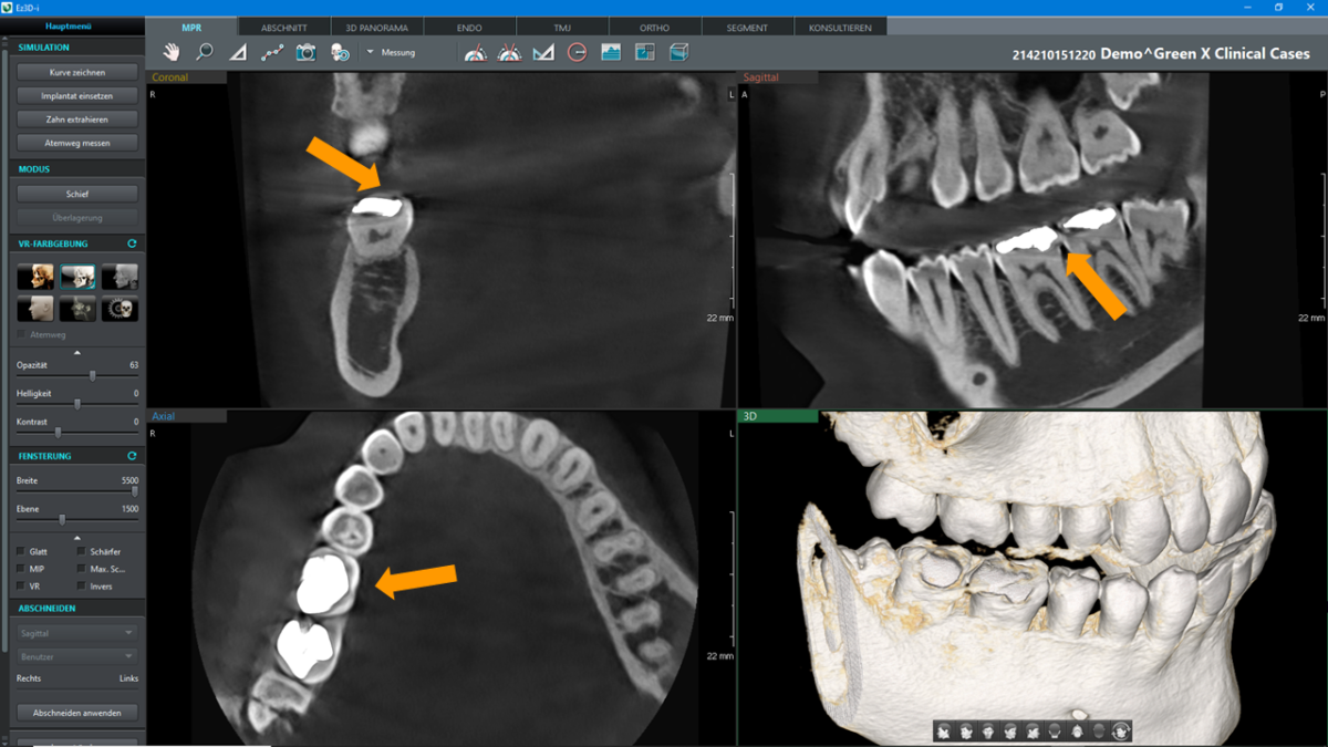 ORANGEDENTAL GREEN Nxt 3D DVT
