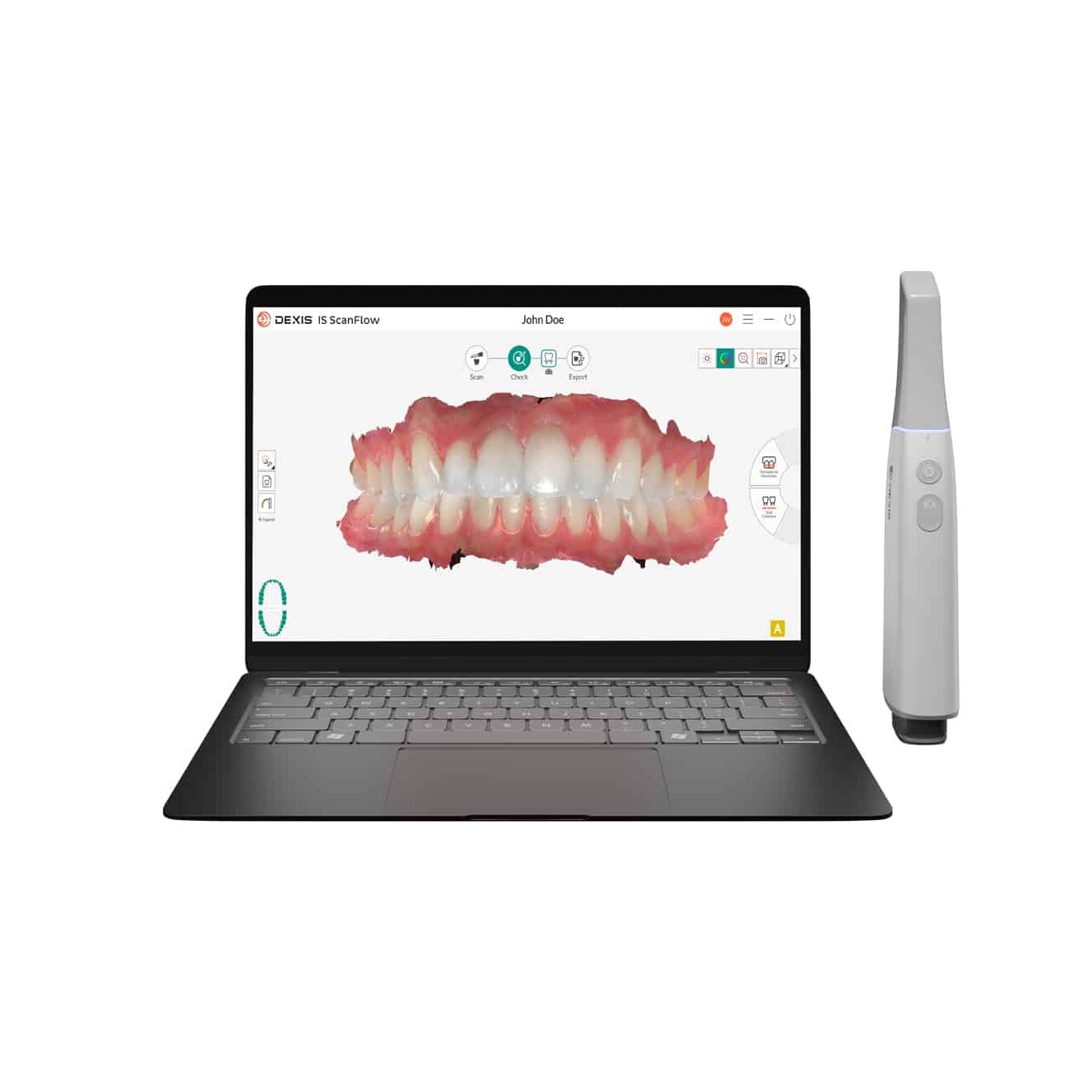 DEXIS Imprevo Wireless Intraoralscanner